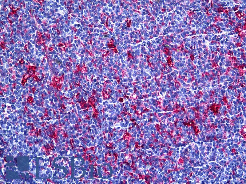 IHC-plus™ Monoclonal Mouse anti-Human GSN / Gelsolin Antibody (clone 3G5, IHC, WB)
