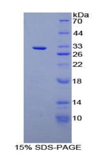 Rat RFNG Protein (Recombinant His-T7)