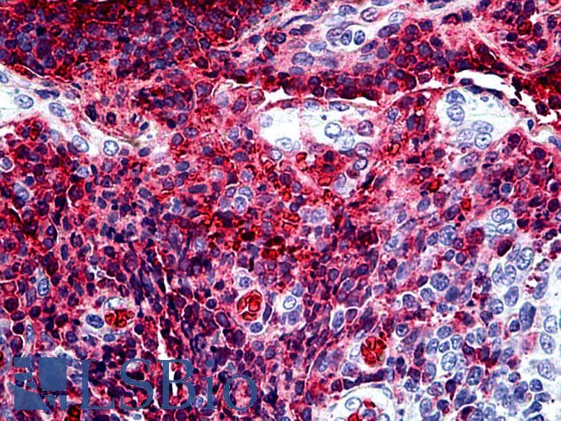 IHC-plus™ TGF-Beta Antibody (clone TB21)