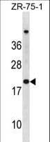 Polyclonal Rabbit anti-Human p16INK4a / CDKN2A Antibody (aa1-30, WB)