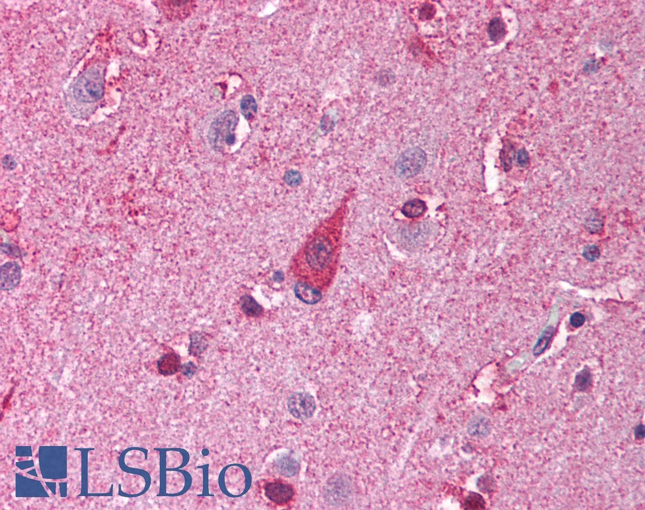 IHC-plus™ Polyclonal Rabbit anti-Human TLR8 Antibody (IHC, IF, WB)