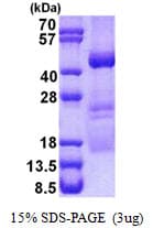 Human OBFC1 Protein (Recombinant His)