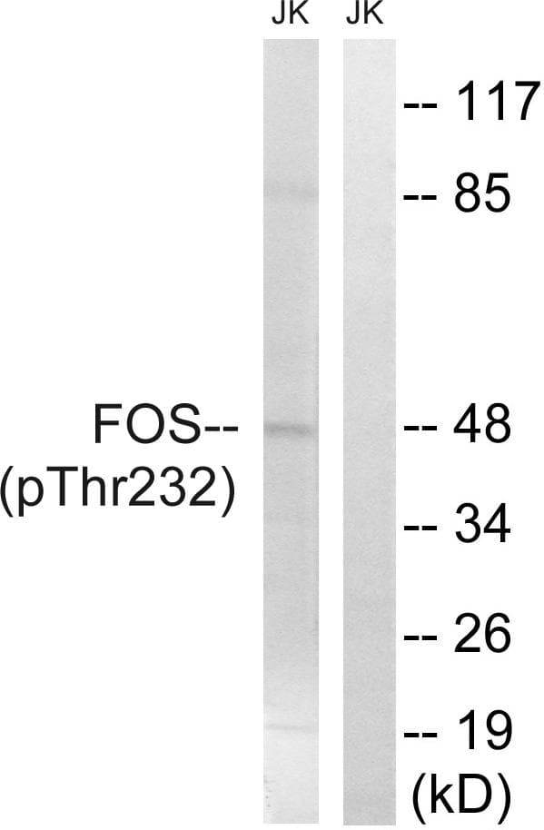 FOS / c-FOS Antibody (phospho-Thr232)