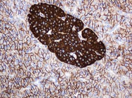 CD99 Antibody (clone OTI2E8)
