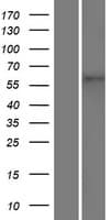TMEM87A Protein (Over-Expression Lysate Myc-DDK (Flag))