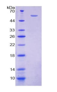 Mouse TXLNA / Alpha Taxilin Protein (Recombinant His-GST)