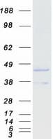 Human SCAD / ACADS Protein (Recombinant Myc-DDK (Flag))