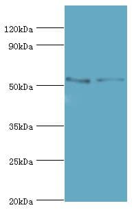 Polyclonal Rabbit anti-Human TFEB Antibody (aa1-220, IHC, WB)