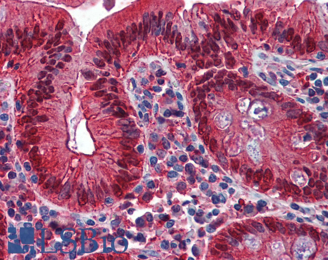 IHC-plus™ GAL4 / Galectin 4 Antibody (clone 1E8)
