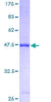 Human RTN4 / Nogo Protein (Recombinant GST)