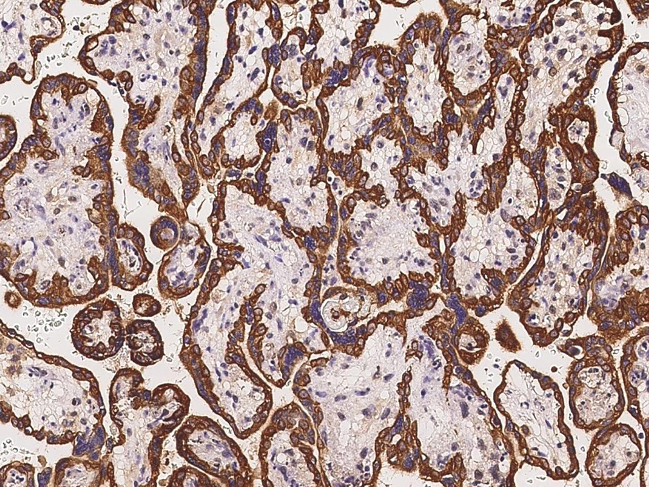 Polyclonal Rabbit anti-Human AHCTF1 / ELYS Antibody (IHC, IF)