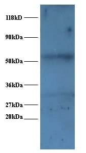 SNRPA / U1A Antibody (FITC)