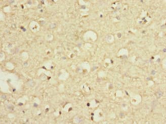 GRM7 / MGLUR7 Antibody
