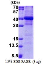 Human NSL1 Protein (Recombinant His)