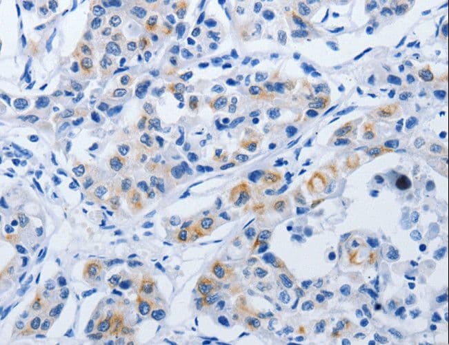 BPIFB3 / C20orf185 Antibody