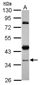Polyclonal Rabbit anti-Human CCDC94 Antibody (WB)