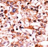 CDK1 / CDC2 Antibody (phospho-Ser39)