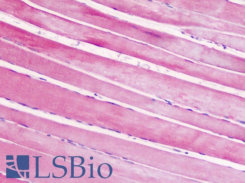 IHC-plus™ CRHR2 / CRF2 Receptor Antibody (aa71-120)
