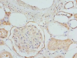 ETFDH Antibody