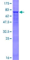Human FBX09 / FBXO9 Protein (Recombinant GST)