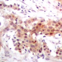 Polyclonal Rabbit anti-Human EP300 / p300 Antibody (Internal, IHC, WB)