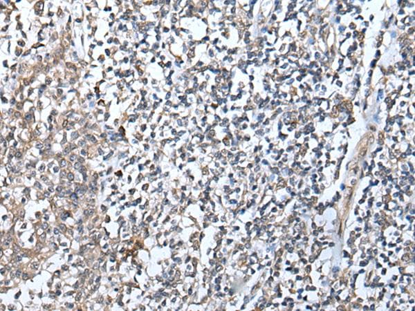 Polyclonal Rabbit anti-Human DEFB104A / BD-4 Antibody (IHC)