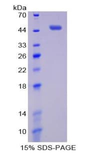 Human PIM1 / Pim-1 Protein (Recombinant His-GST)