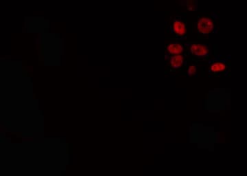 Polyclonal Rabbit anti-Human DYRK / DYRK1A Antibody (IF, WB)