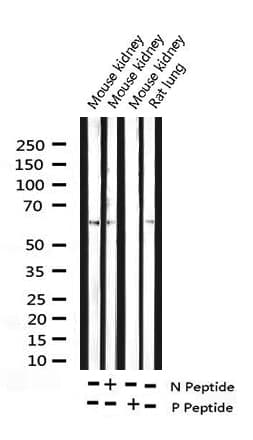 Polyclonal Rabbit anti-Human CCNB1 / Cyclin B1 Antibody (phospho-Ser147, IHC, IF, WB)