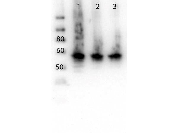 CDG1C / ALG6 Antibody (N-Terminus)