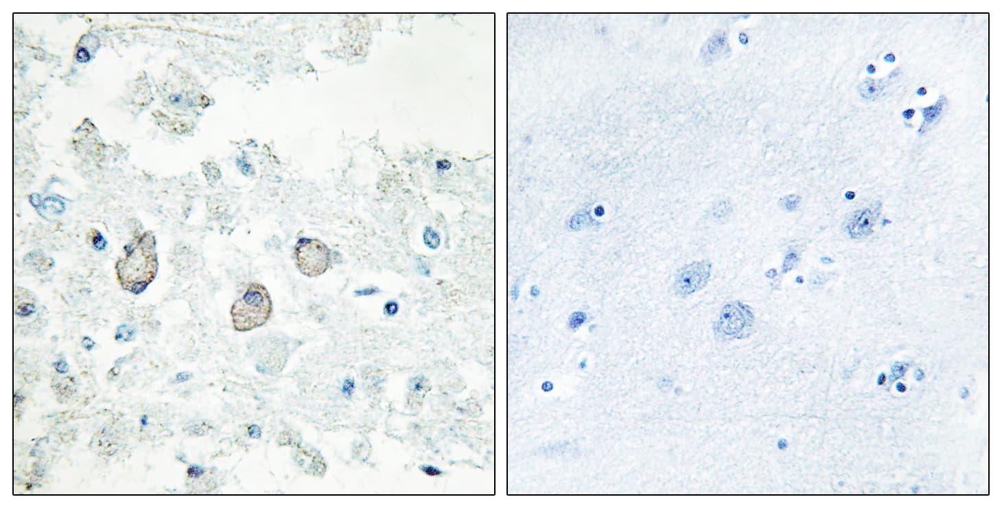 Polyclonal Rabbit anti-Human DOK7 Antibody (aa10-59, IHC, IF, WB)