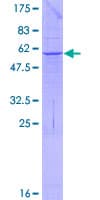 Human PPT2 Protein (Recombinant GST)