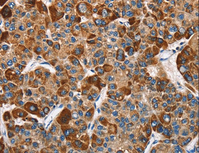 SLAMF8 Antibody