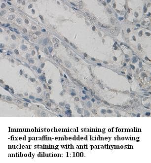 PTMS / Parathymosin Antibody (C-Terminus)