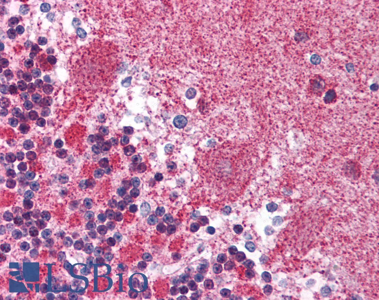 KIF23 / MKLP1 Antibody (aa32-81)