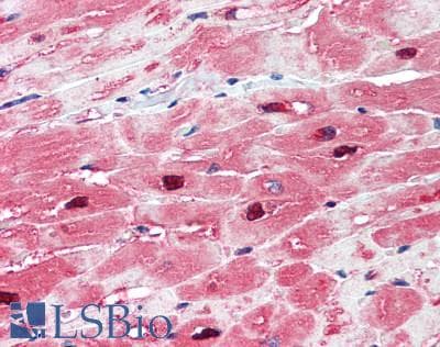 IHC-plus™ TPI1 / TPI Antibody