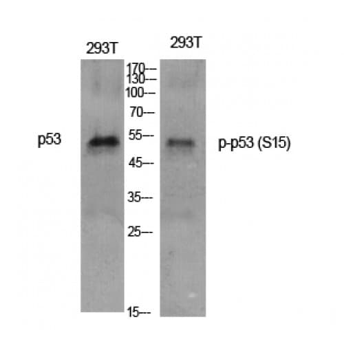 Polyclonal Rabbit anti-Human TP53 / p53 Antibody (1-80 aa, IHC, IF, WB)