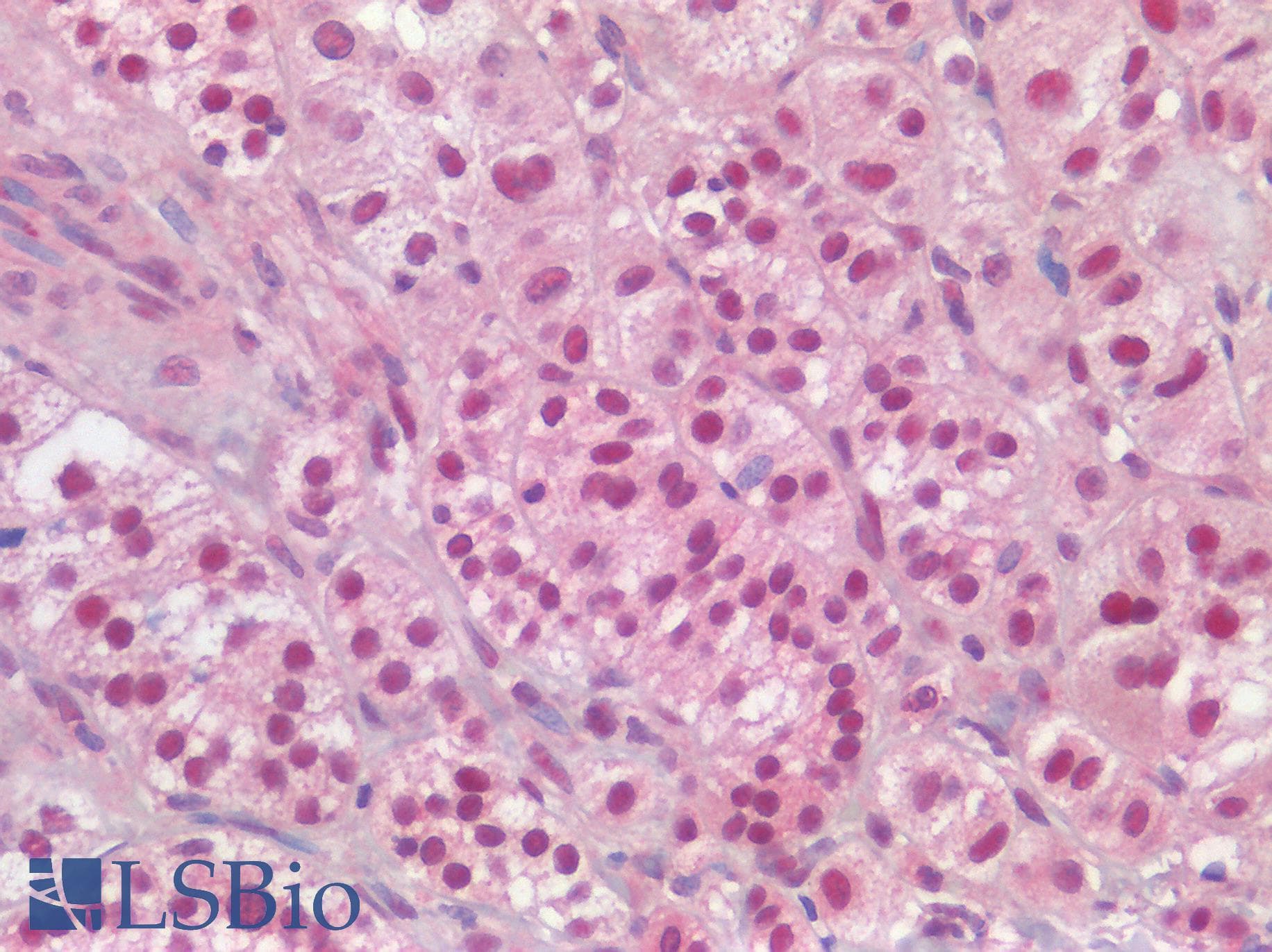 IHC-plus™ ARID1A / BAF250 Antibody