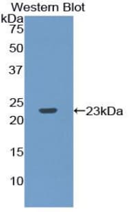 RPP40 / Ribonuclease P Antibody (aa91-259)