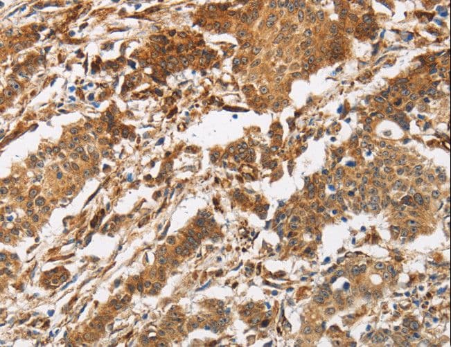 Polyclonal Rabbit anti-Human CALU / Calumenin Antibody (IHC)