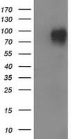 VCAM1 / CD106 Antibody (clone OTI2G5)