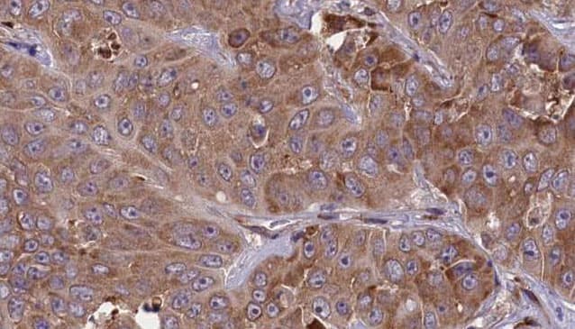 CCR1 Antibody