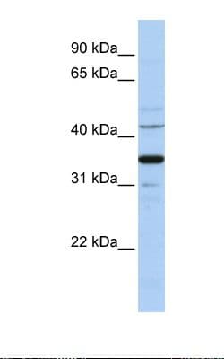 WNT5A Antibody (aa180-229)