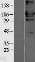 Human HK2 / Hexokinase 2 Protein (Over-Expression Lysate Myc-DDK (Flag))
