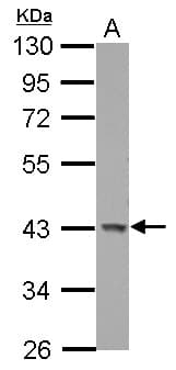 GALK1 / GK1 Antibody