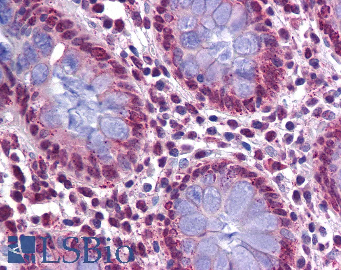 IHC-plus™ QIP1 / KPNA4 Antibody