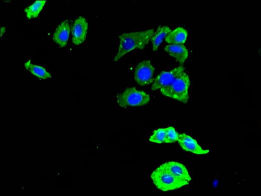 IHC-plus™ DDR2 Antibody