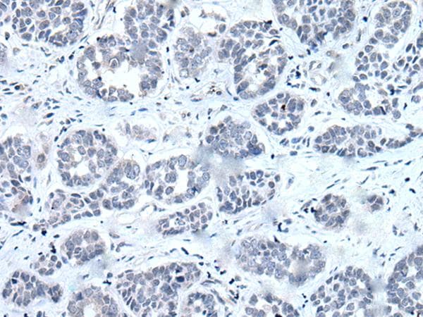 RARG / RAR-Gamma Antibody