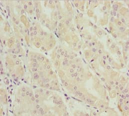 Polyclonal Rabbit anti-Human DDX11 / CHLR1 Antibody (IHC)