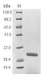 Human SFTPB / Surfactant Protein B (Recombinant 6His-SUMO, N-terminus)
